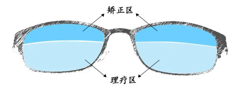 永康降度视力矫正加盟条件 永康降度视力矫正加盟条件
