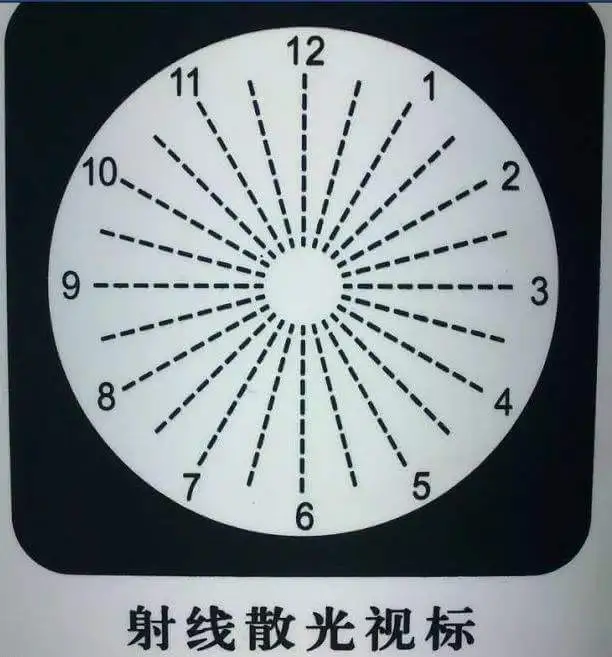 鹰视力加盟优势 鹰视力加盟优势